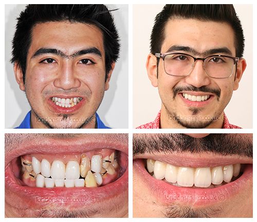 Patient trauma smile story